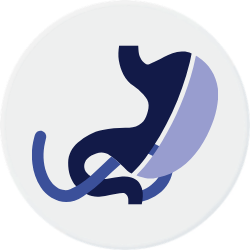Icono switch duodenal